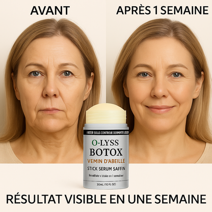 Le secret d’une peau ferme, sans douleur ni chirurgie